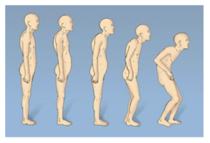 Body posture